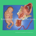 Modèle de démonstration de l&#39;ISO sur l&#39;accouchement, processus de livraison du terme Fetus